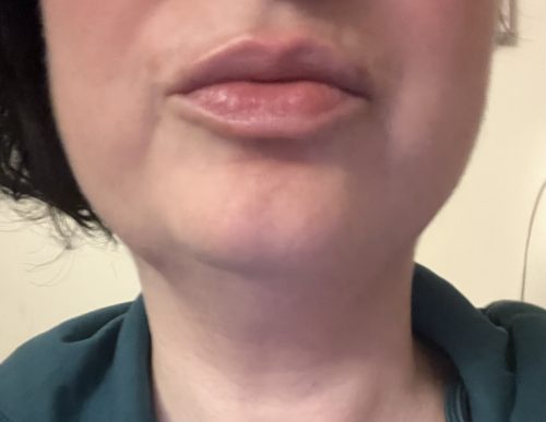 FULL LIPS - Άμεσα σαρκώδη χείλη, ογκώδη, παχιά και λεία - βαθιά ενυδάτωση που διαρκεί photo review