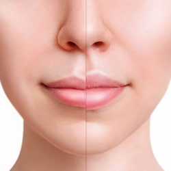 Full Lips® Lip Plumper Gloss για Γεμάτα Χείλη - Image 4