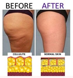 Anti-Cellulite® Κρέμα Αντικυτταριδικής Δράσης 250ml - Image 6