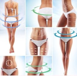 Anti-Cellulite® Κρέμα Αντικυτταριδικής Δράσης 250ml - Image 5