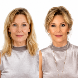 Collagen Lift® Foundation Φυσικής Κάλυψης & Λάμψης - Image 7