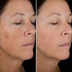 Le Serum® Ορός Βιταμίνης C για Λάμψη & Τόνωση - Image 7