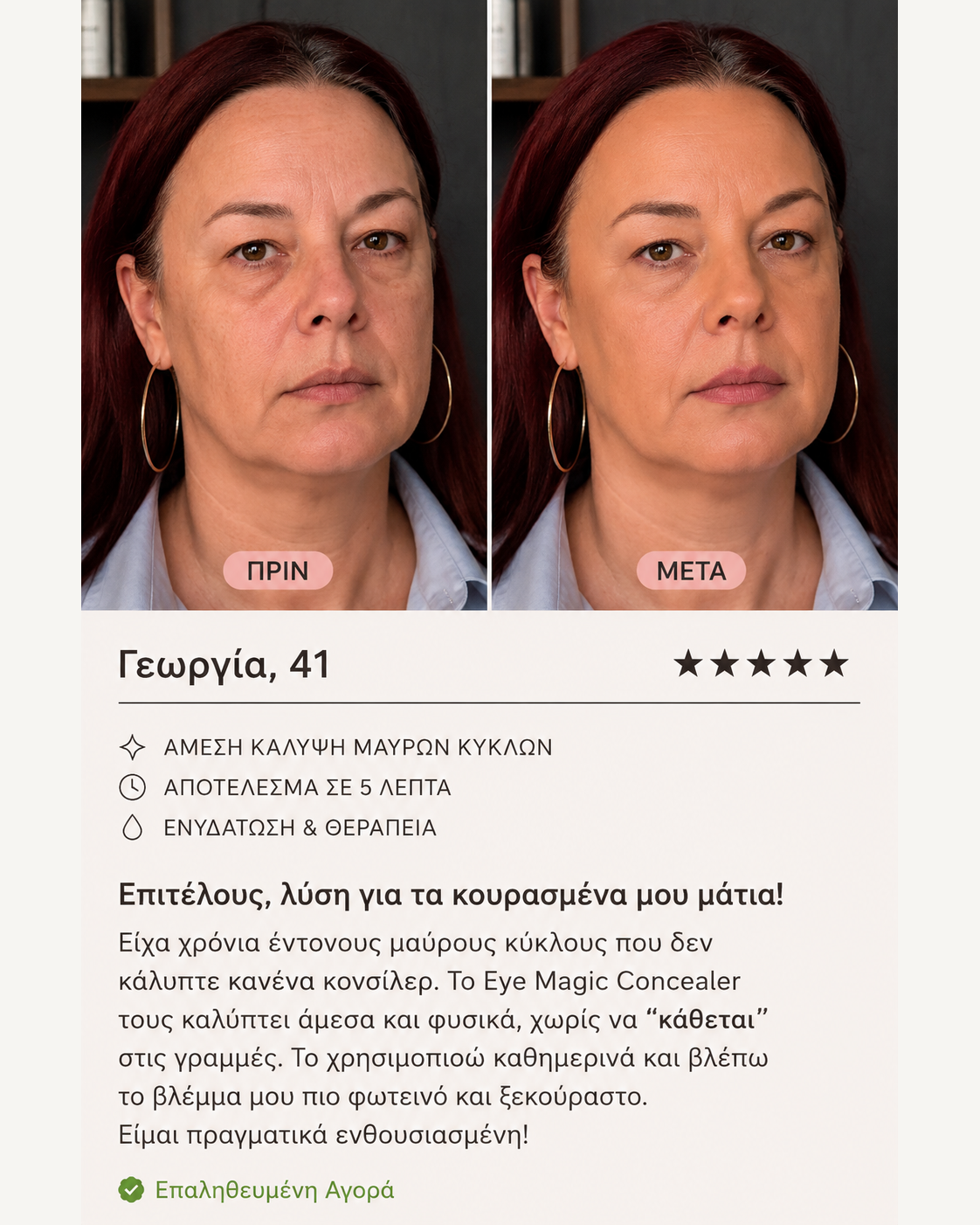 Product-EyeMagic-BeforeAfterReviews-44564