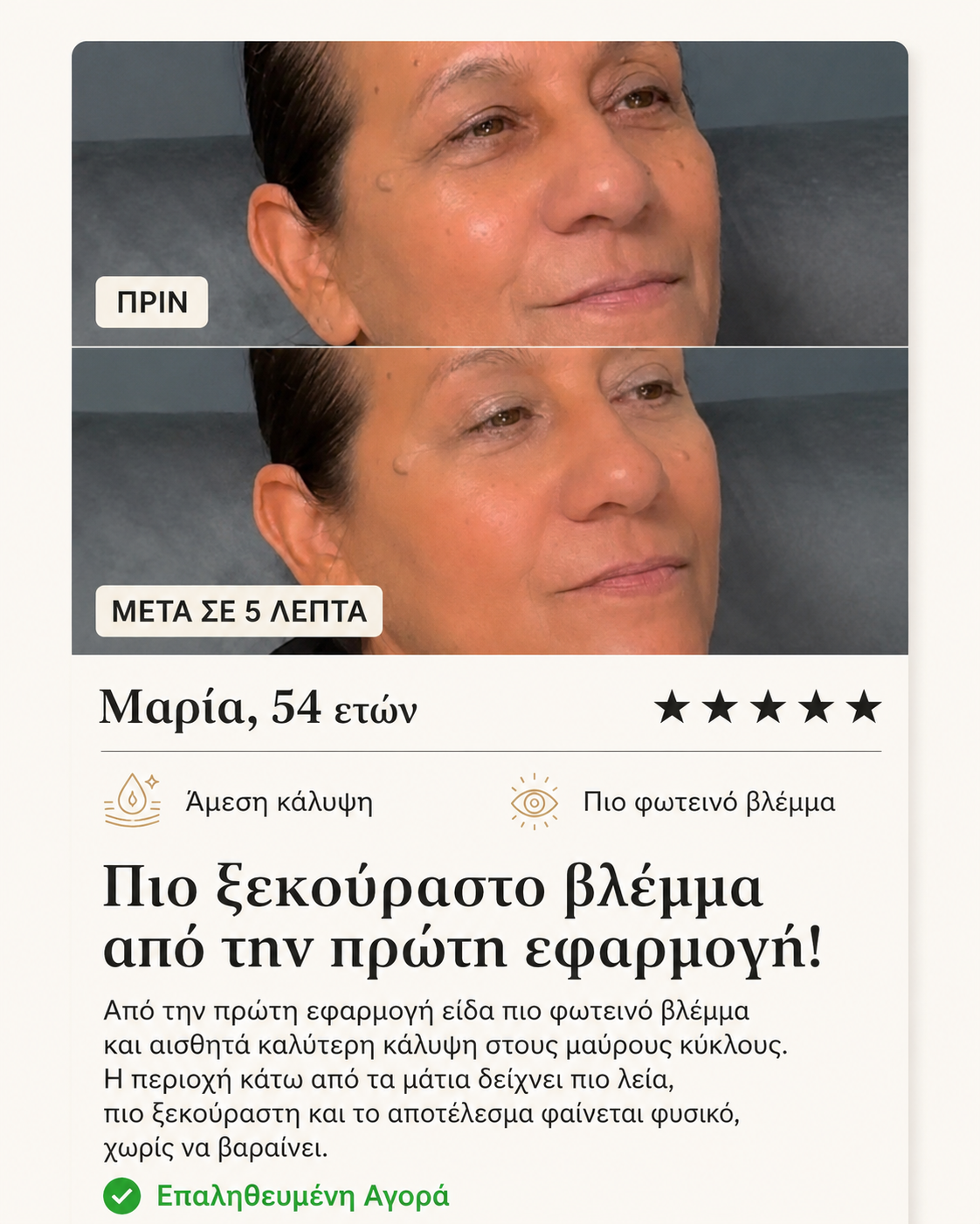 Product-EyeMagic-BeforeAfterReviews-44566